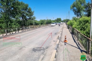 В Биробиджане 21-летний пешеход пострадал от вылетевшего из-под колеса авто камня