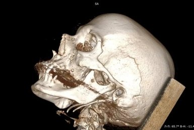 5929243.jpg?143a7bc4999bd45fdbcebd242b3f5cae