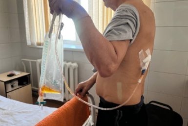 73-летний житель Забайкалья поделился страшными последствиями многолетнего курения пресс-служба министерства здравоохранения края