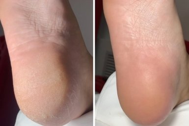 Домашние тапочки — ключ к мягким пяткам