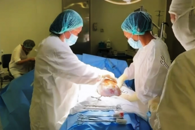 В Бурятии пациентке удалили опухоль размером с футбольный мяч