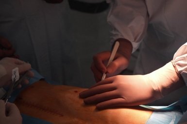 Иркутские хирурги удалили деталь катетера из грудной клетки юного спортсмена