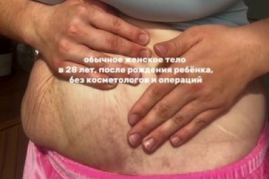 Блогер из Иркутска показала тело после родов и вызвала шквал критики