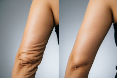 Руки как у модели без спортзала: одно движение у стены — и %22крылья%22 тают к маю