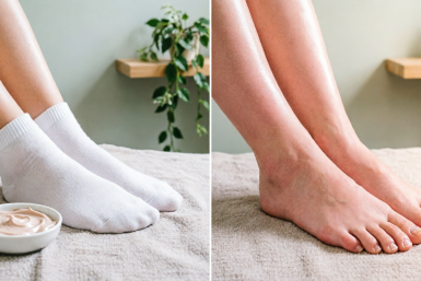 Пропитываю носки 1 смесью — мощная "пилинг-маска" готова: грубые пятки стали нежнее шелка