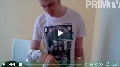 Денис Удовенко с протезом кадр Prim.TV Денис Удовенко с протезом кадр Prim.TV