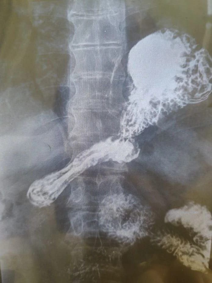 Пресс-служба Краевой клинической больницы № 2