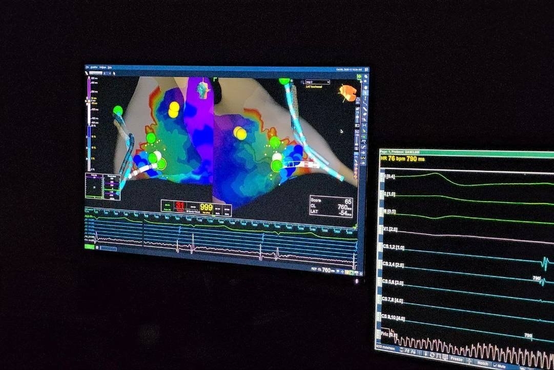 В Иркутской областной больнице впервые провели операции с внутрисердечным УЗИ Пресс-служба облправительства