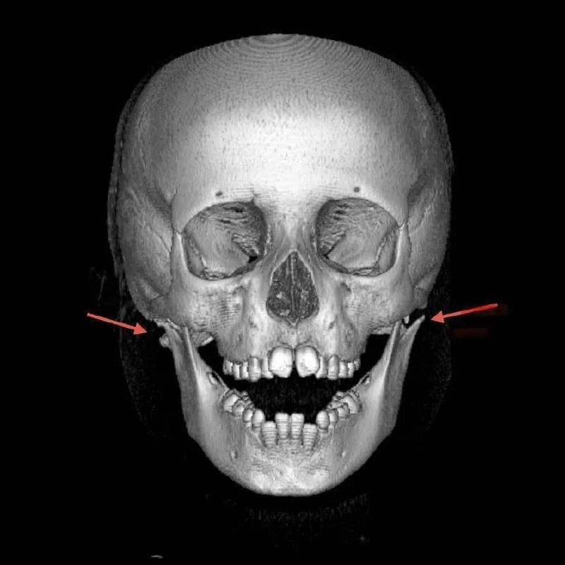 тг-канал (18+) Минздрав Приморья