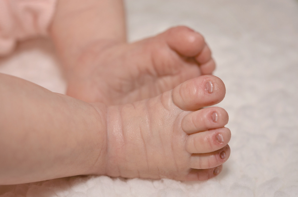 Тематическое фото pxhere.com