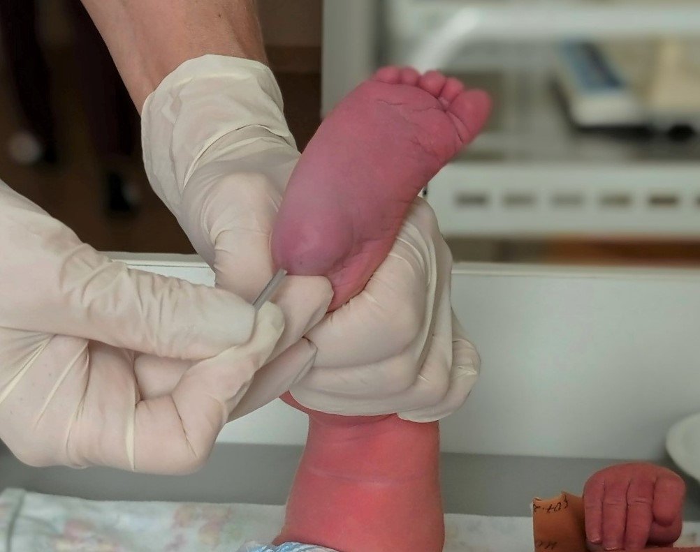 Для исследований требуется несколько капель крови из пятки малыша министерство здравоохранения Амурской области