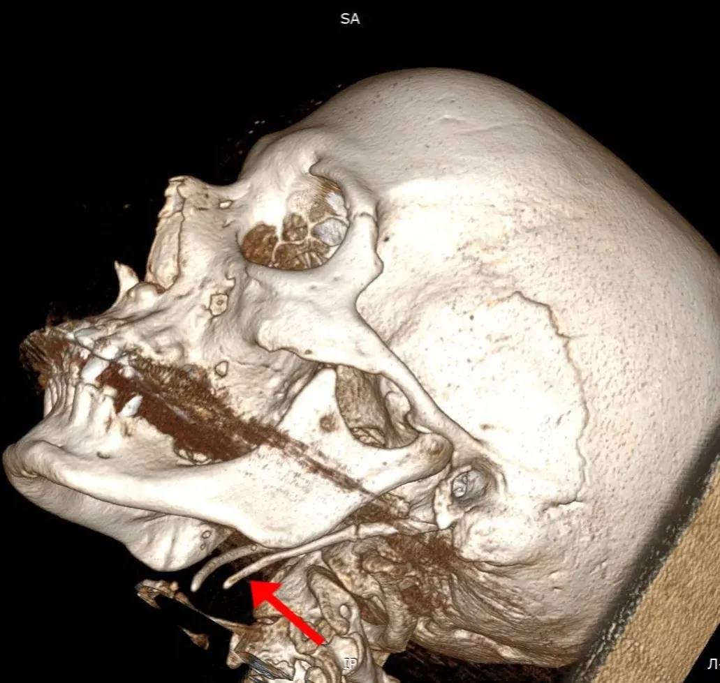 ККБ профессора Владимирцева