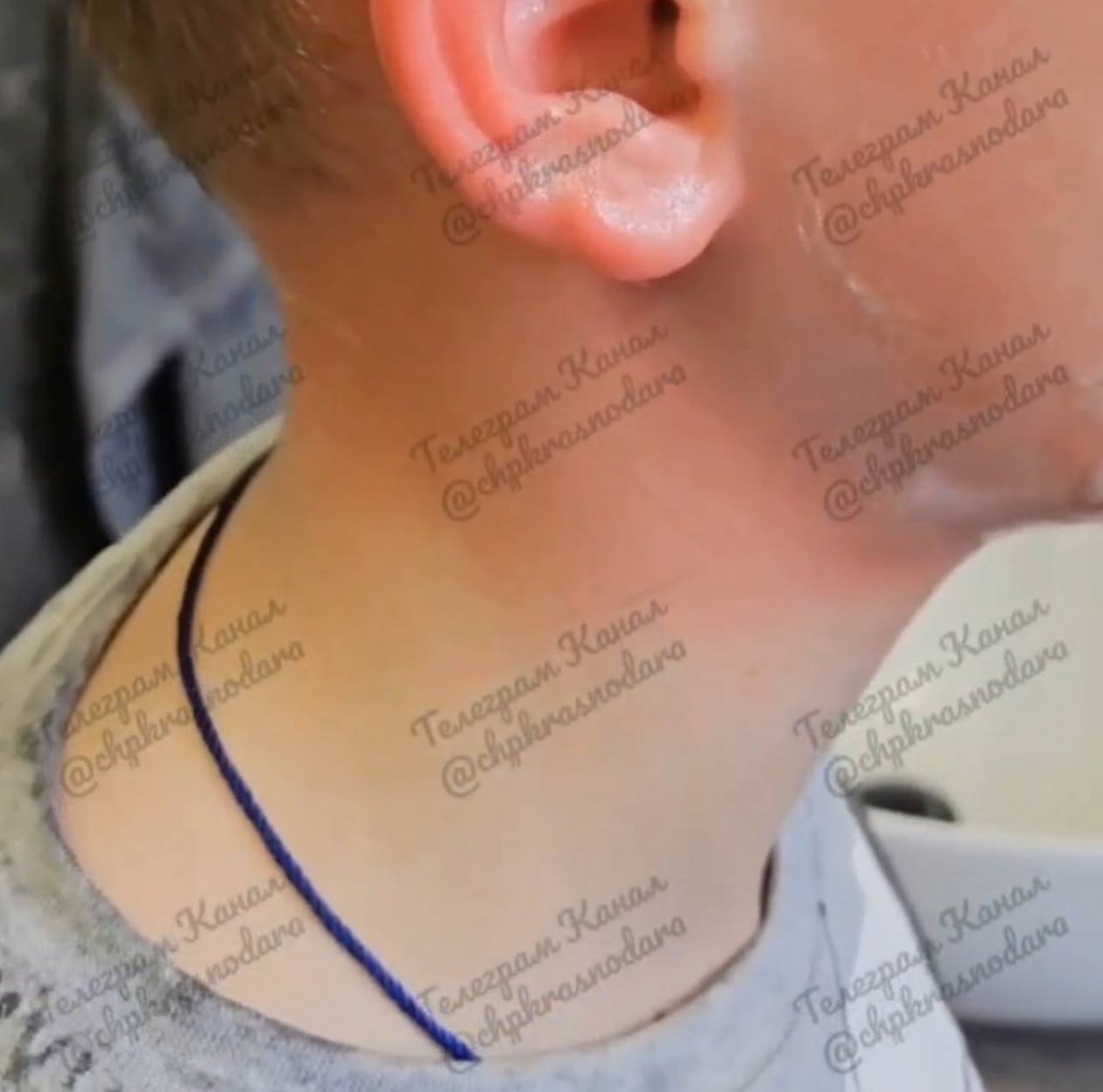 Подростки залили глаза из баллончика 11-летнему ребенку в Краснодаре скрин t.me/chpkrasnodara