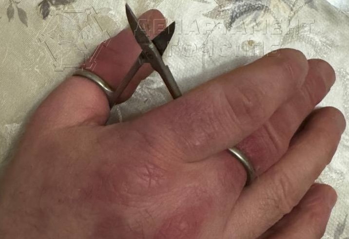 Москвич оказался в заложниках маникюрных ножниц Telegram-канал департамента ГОЧСиПБ