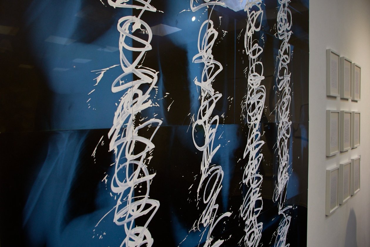 Работа с рентгеновскими снимками Дмитрий Осипчук, ИА PrimaMedia