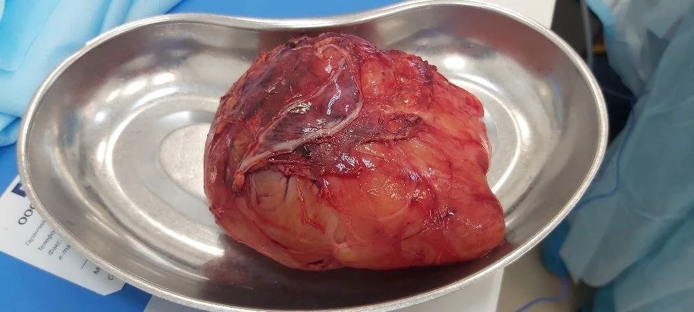 Tg-канал (18+) Краевой клинической больницы № 2