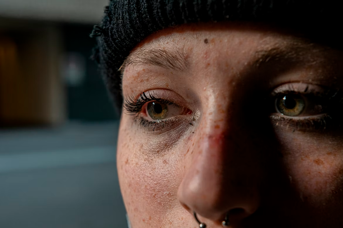 8 причин, из-за которых появляются синяки под глазами unsplash.com