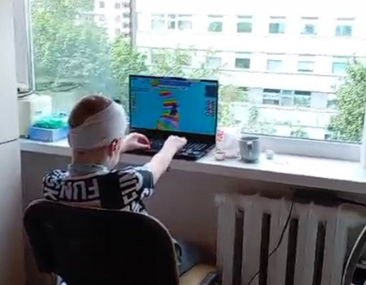 Пострадавший от хаски мальчик из Сочи впервые за год задышал самостоятельно Соцсети Валентина Королева