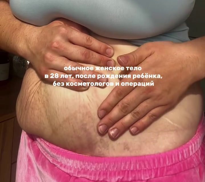Блогер из Иркутска показала тело после родов и вызвала шквал критики Из соцсети блогера