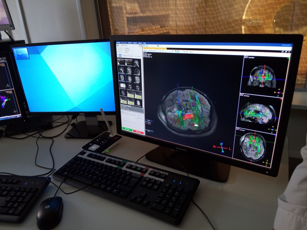 Трехтесловый МРТ презентовали в республиканской больнице №2 в Якутске