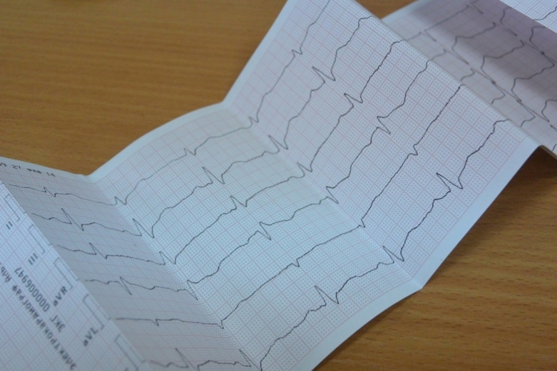 Врач назвала три неочевидных признака инфаркта Автор: Наталья Баграновская, ИА EAOmedia