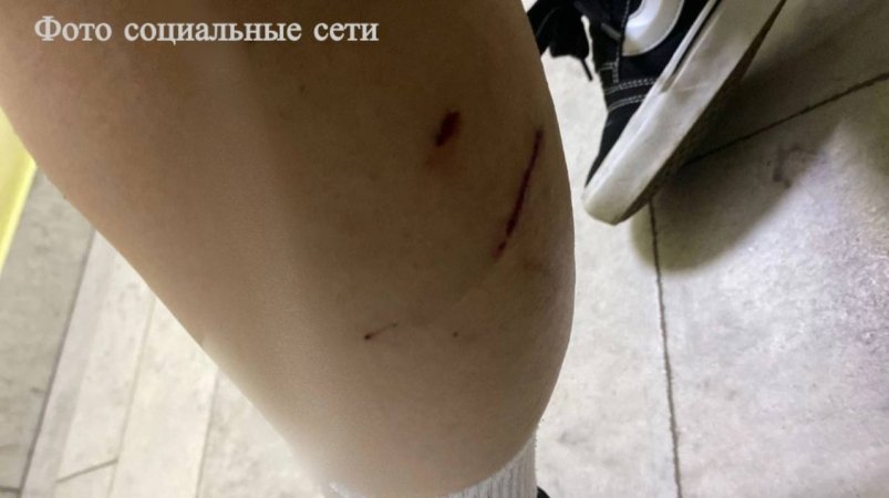 Сведения о нападении бродячих собак на 16-летнюю девушку проверяют на Ставрополье пресс-служба СУ СКР Ставрополья