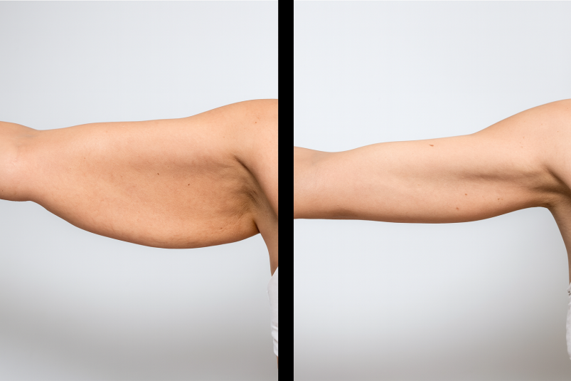 Тематическое фото Изображение сгенерировано ИИ Qwenlm.a (18+).