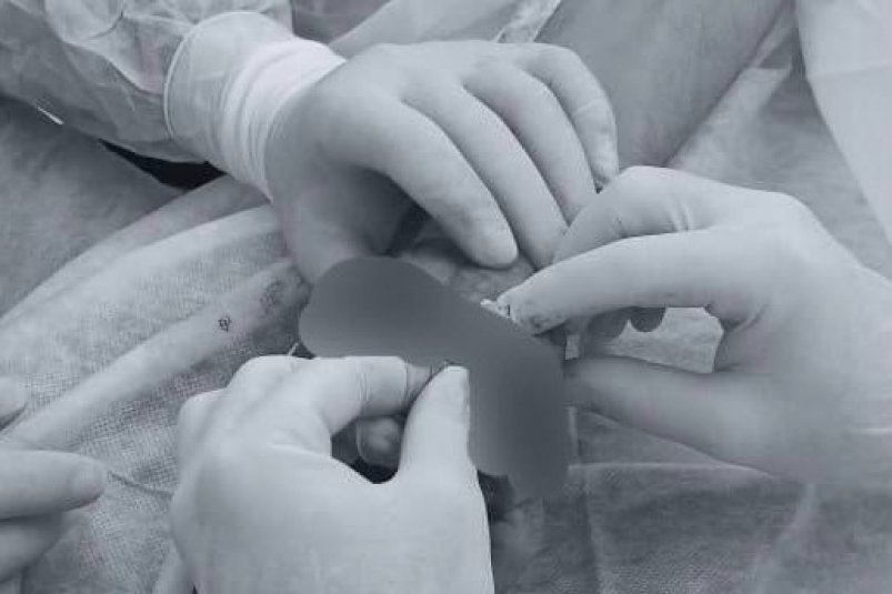 Операция ГКБ Пятигорска