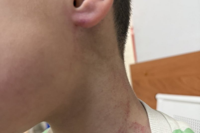 Травмы ребенка Межрегиональный центр по правам детей