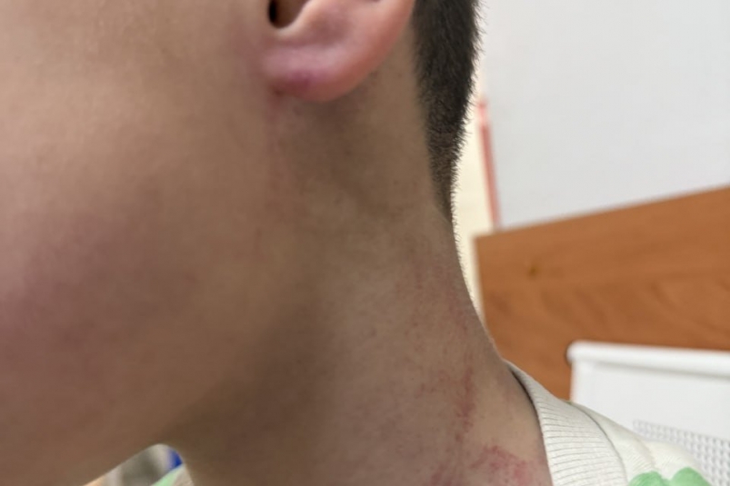 Мэр Иркутского района прокомментировал инцидент с тренером и ребенком в детсаду Межрегиональный центр по правам детей