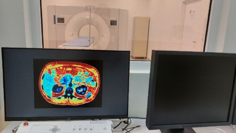 ИИ в здравоохранении Якутии: 67 тысяч исследований обработано за год YakutiaMedia