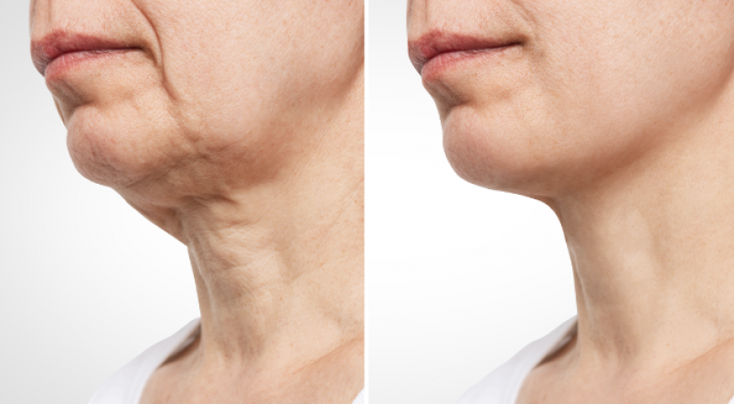 Тематическое фото Дзен-канал "Стань краше с Орловой Дашей" (18+)