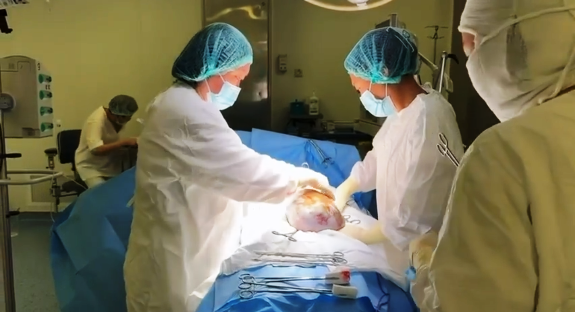 В Бурятии пациентке удалили опухоль размером с футбольный мяч Республиканский онкодиспансер Бурятии